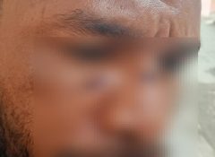 Diduga Dipicu Miras, Polres Jayapura Usut Kasus Pengeroyokan di Sentani 